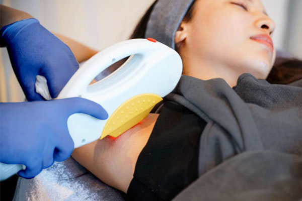 IPL Hair Removal, Perawatan Menghilangkan Bulu Secara&nbsp;Permanen